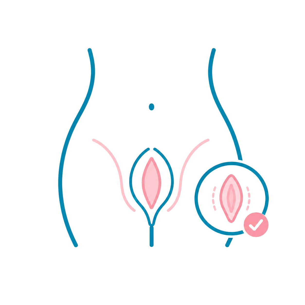 위례나무의원_소음순성형
